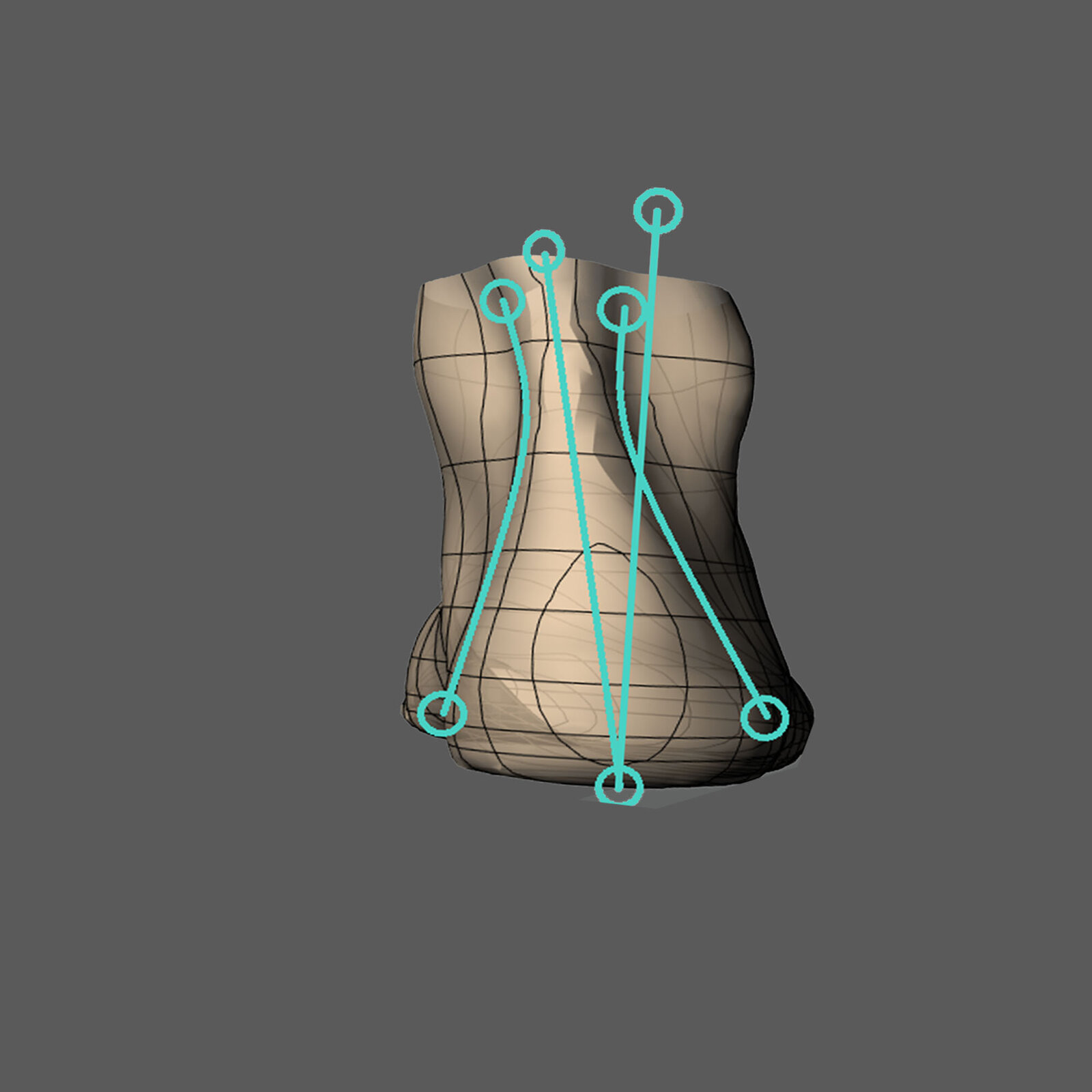 Custom 3D printed orthotic, rear view
